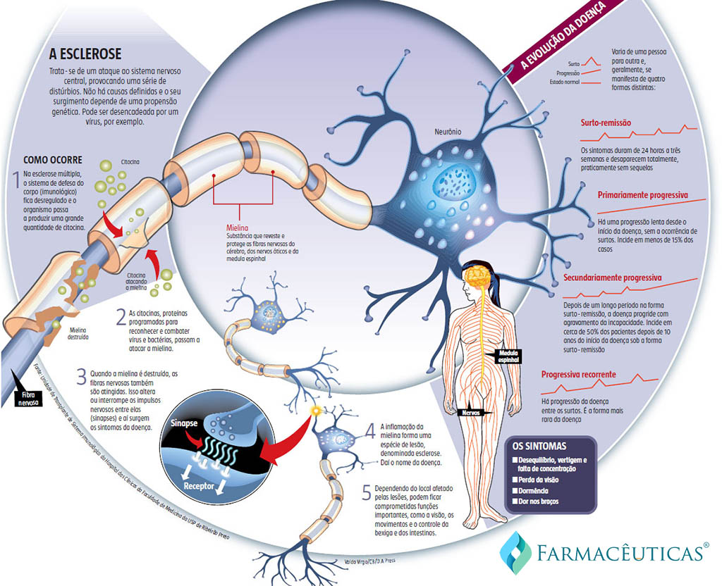 esclerose-multipla-infografico